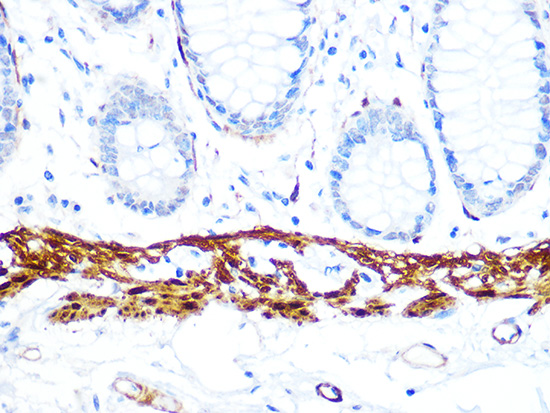 Calponin Rabbit monoclonal antibody
