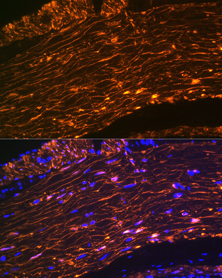 Calponin Rabbit monoclonal antibody