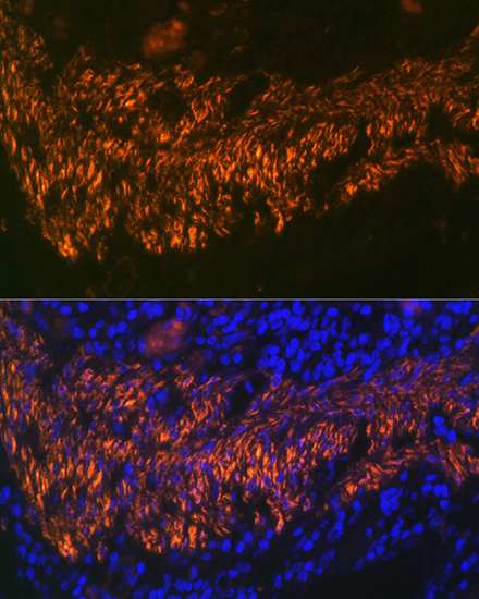 Calponin Rabbit monoclonal antibody