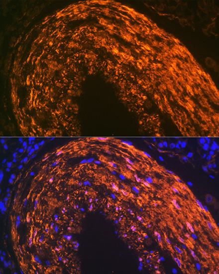Calponin Rabbit monoclonal antibody