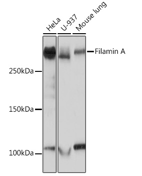 Filamin A Rabbit monoclonal antibody