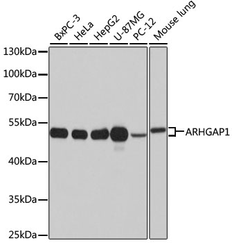ARHGAP1 Rabbit polyclonal antibody