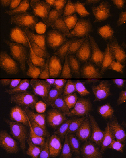 ASNA1 Rabbit polyclonal antibody
