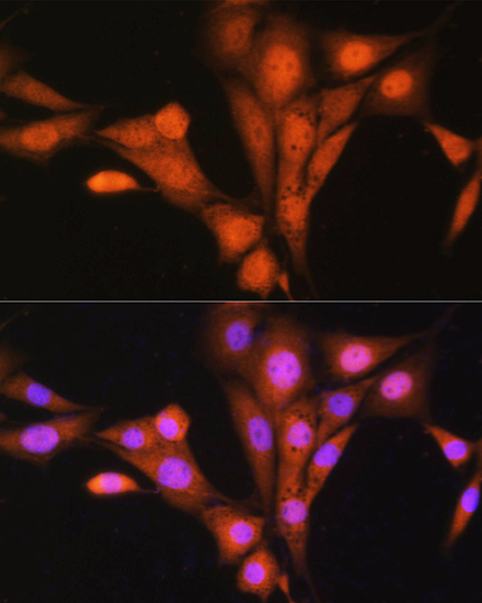 ASNA1 Rabbit polyclonal antibody