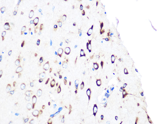 PUMA Rabbit monoclonal antibody