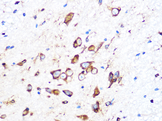 PUMA Rabbit monoclonal antibody