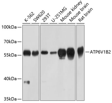 ATP6V1B2 Rabbit polyclonal antibody