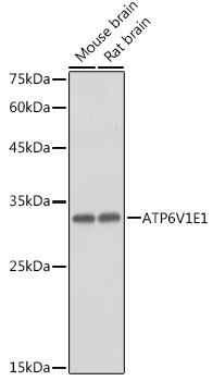 ATP6V1E1 Rabbit polyclonal antibody