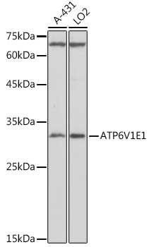 ATP6V1E1 Rabbit polyclonal antibody