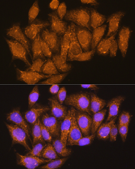 ATP6V1E1 Rabbit polyclonal antibody