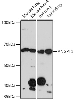 ANGPT1 Rabbit monoclonal antibody