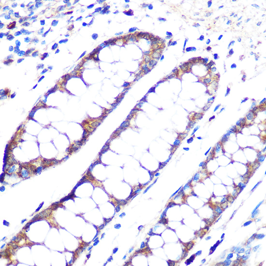 ANGPT1 Rabbit monoclonal antibody