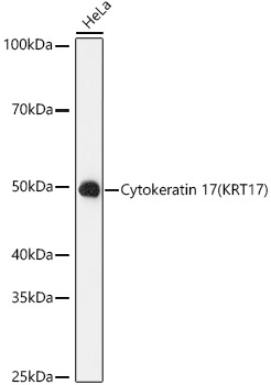 Cytokeratin 17 (KRT17) Rabbit mAb