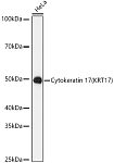 Western blot - Cytokeratin 17 (KRT17) Rabbit mAb (A3769)
