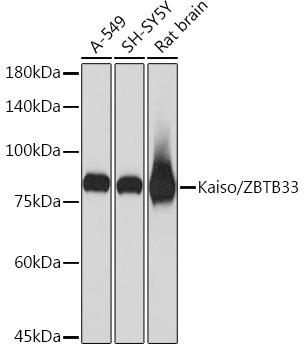 Kaiso/ZBTB33 Rabbit monoclonal antibody