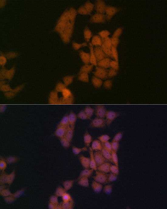 Kaiso/ZBTB33 Rabbit monoclonal antibody
