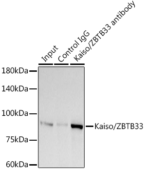 Kaiso/ZBTB33 Rabbit monoclonal antibody