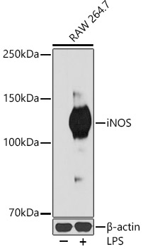 iNOS Rabbit monoclonal antibody