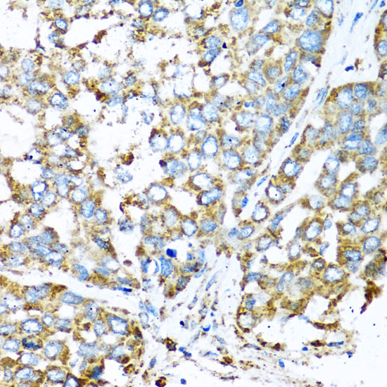 COX6A1 Rabbit polyclonal antibody