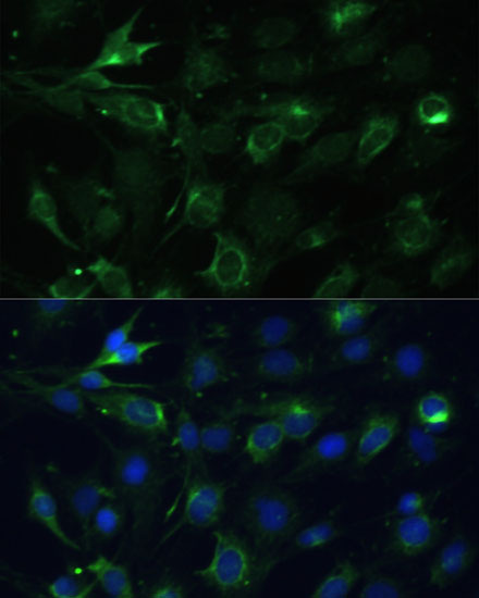 COX6A1 Rabbit polyclonal antibody