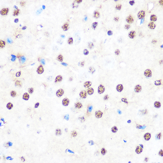 NONO/p54nrb Rabbit monoclonal antibody
