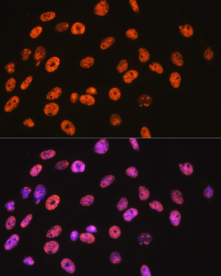 NONO/p54nrb Rabbit monoclonal antibody