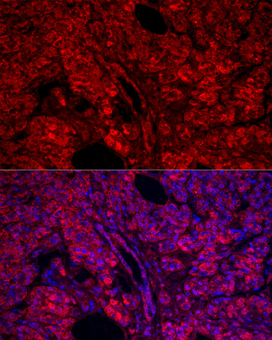 CPA1 Rabbit polyclonal antibody