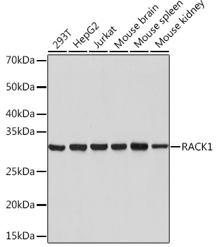 RACK1 Rabbit monoclonal antibody