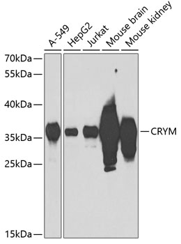 CRYM Rabbit polyclonal antibody