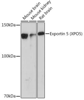 Exportin 5 (XPO5) Rabbit monoclonal antibody