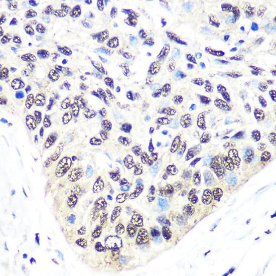 Exportin 5 (XPO5) Rabbit monoclonal antibody