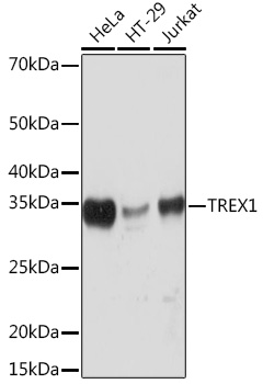 TREX1 Rabbit monoclonal antibody