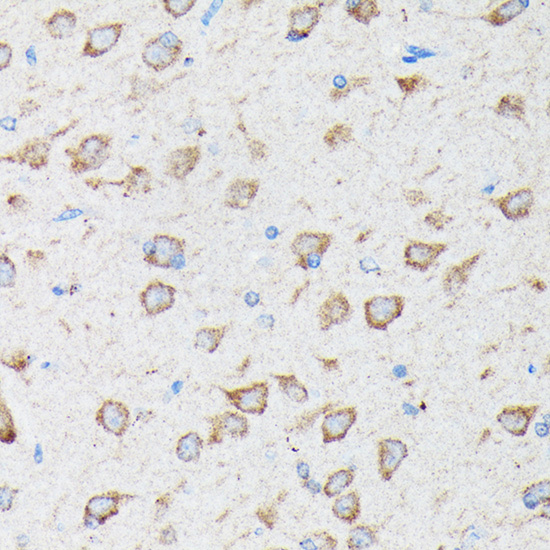 CYLD Rabbit polyclonal antibody