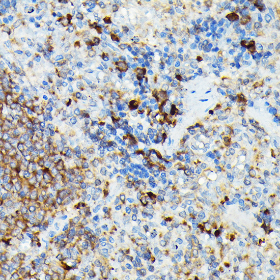 CYLD Rabbit polyclonal antibody