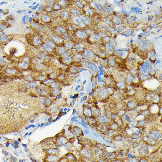 CYLD Rabbit polyclonal antibody