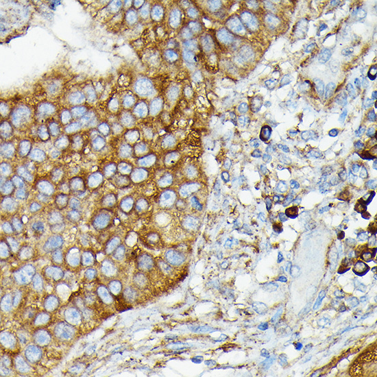 CYLD Rabbit polyclonal antibody