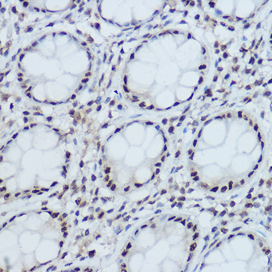 DDB1 Rabbit polyclonal antibody