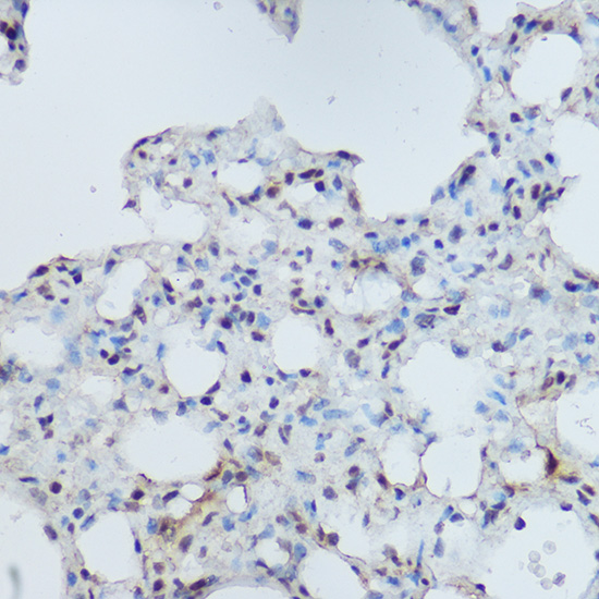DDB1 Rabbit polyclonal antibody