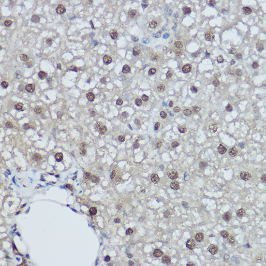 DDB1 Rabbit polyclonal antibody