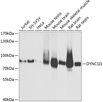 DYNC1I1 Rabbit polyclonal antibody