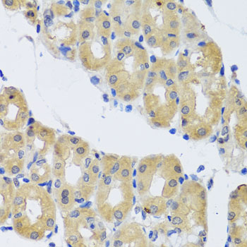 DYNC1I1 Rabbit polyclonal antibody