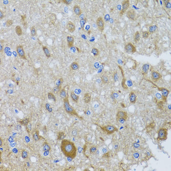DYNC1I1 Rabbit polyclonal antibody
