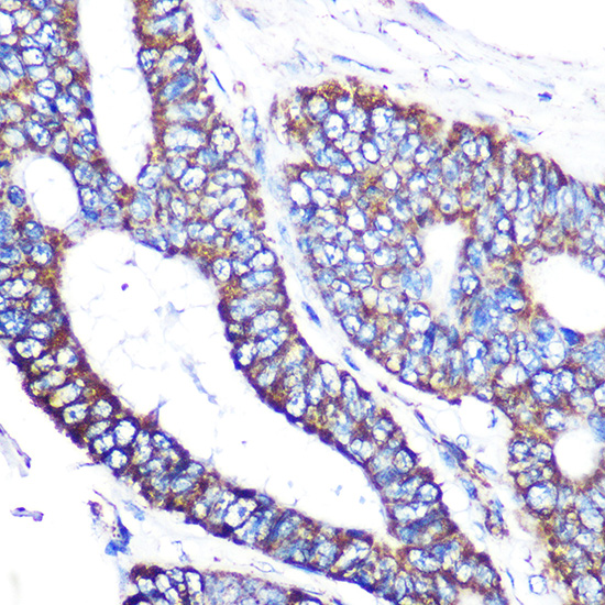 MTCO2 Rabbit monoclonal antibody