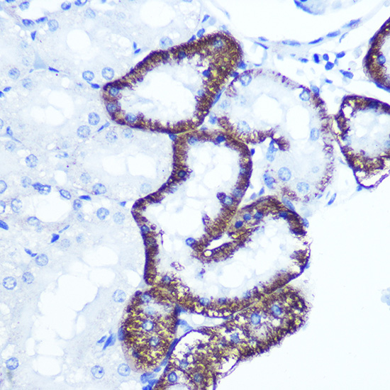 EXTL3 Rabbit polyclonal antibody