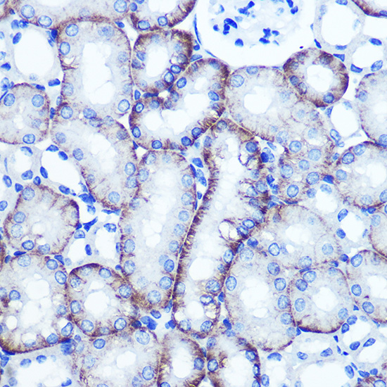 EXTL3 Rabbit polyclonal antibody
