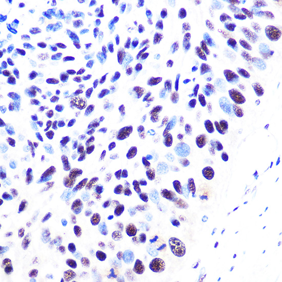 53BP1 Rabbit monoclonal antibody