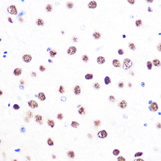 53BP1 Rabbit monoclonal antibody