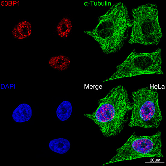 53BP1 Rabbit monoclonal antibody