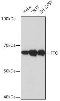 [KO Validated] FTO Rabbit monoclonal antibody