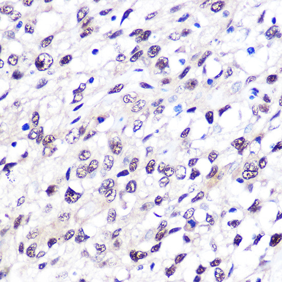[KO Validated] FTO Rabbit monoclonal antibody